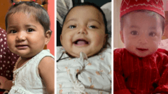 Children keep dying in a country that made huge progress on measles
